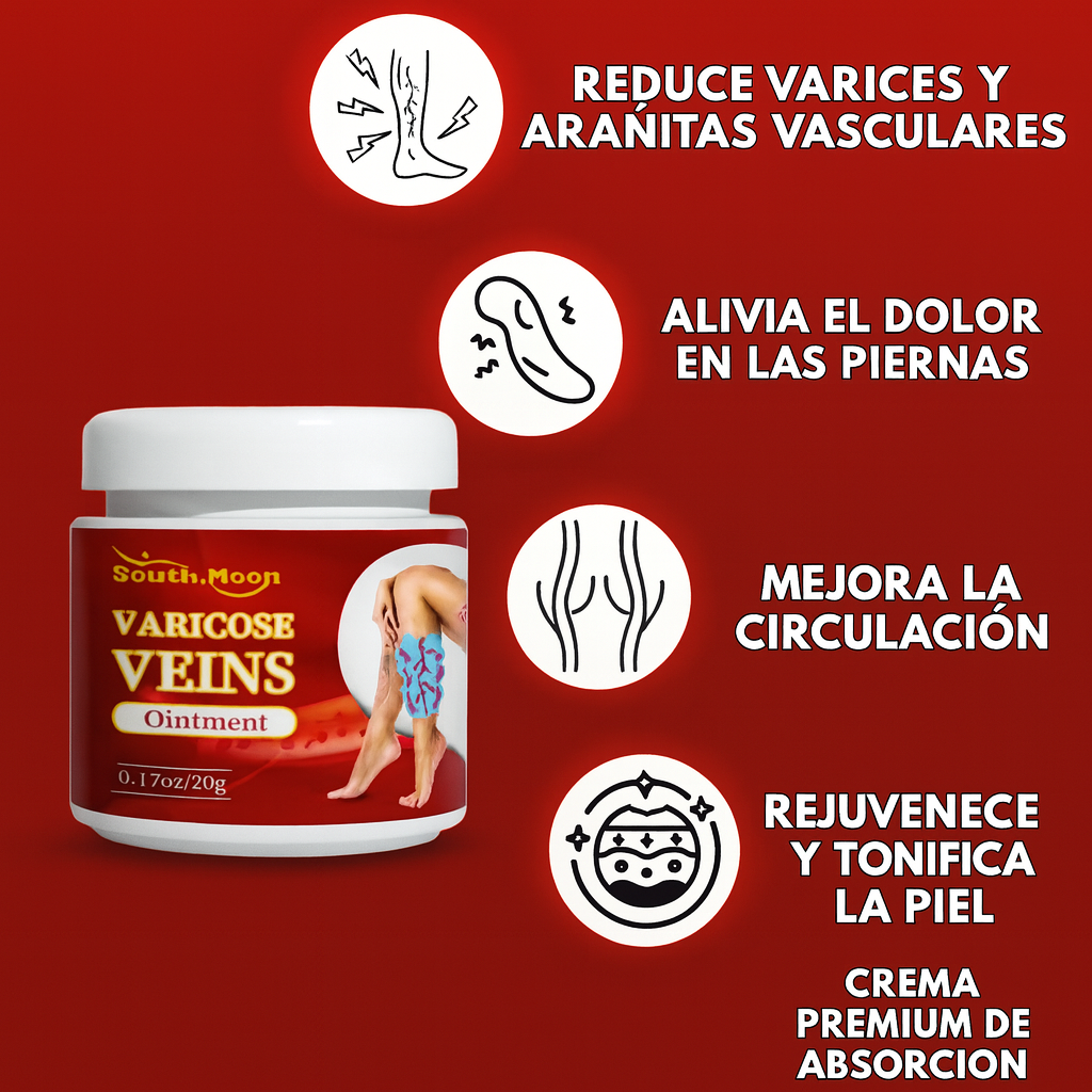 VARICOSE VEINS