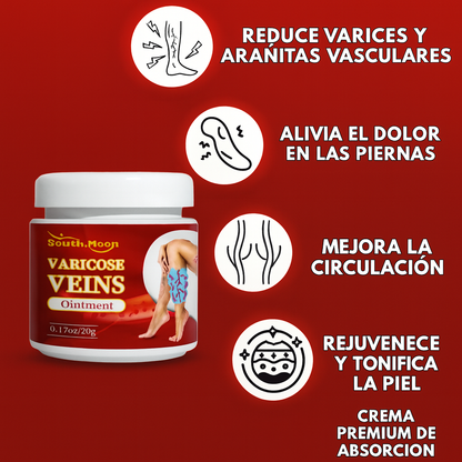 VARICOSE VEINS